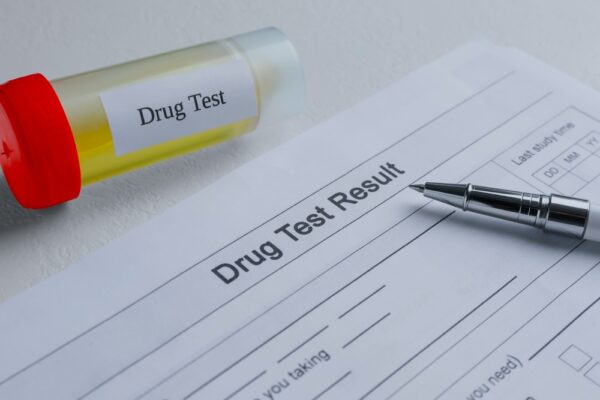 Paper form for drug test results with urine plastic container in the background