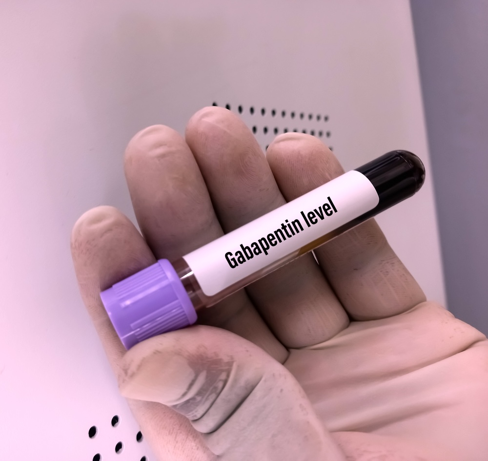 A blood vial with blood in it is used for measuring gabapentin levels in the system